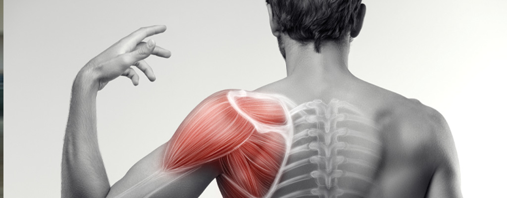 A Comprehensive Look at How Posture Affects the Shoulder